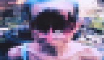【一部閲覧注意】なんJ 世界の奇病部