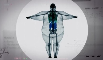 【驚愕】超巨漢をX線で撮影した結果wwwwww