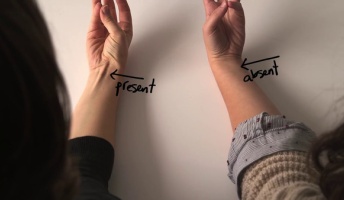 親指と小指をくっつけて、手首を内側に曲げる → 筋が出ない人は進化した人類