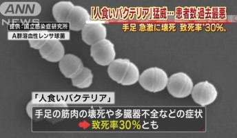 急激に手足が壊死したり、多臓器不全を起こす「人食いバクテリア」が日本で猛威