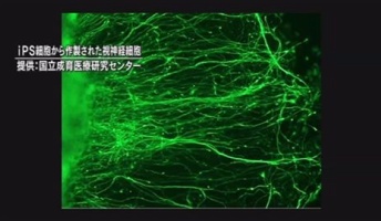 【再生医療】iPS細胞から視神経細胞作製に成功、世界初