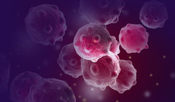 ワイ「なんか腹痛いな、病院行こ」→スキルス胃癌、ステージ3!w