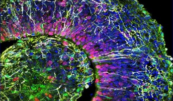 研究室で培養されたヒト脳細胞「ミニブレイン」から人間の脳波が観測されてしまう