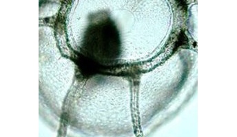 世界で唯一、死なない生物「ベニクラゲ」 繁殖後に幼生に若返るサイクルを繰り返し、永遠に生存し続ける