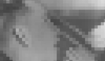 【閲覧注意】精神外科(ロボトミー)とかいう実際にあったマジキチ医学