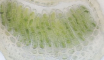 不老不死の夢叶う!?-科学者がある線虫から老化プロセスのスイッチをオフにする方法を発見