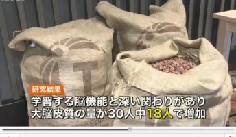 【話題】カカオの多いチョコレート “脳の若返り”可能性も