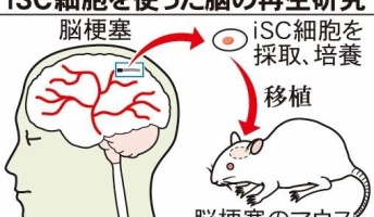 【再生医療】脳梗塞で死んだ脳神経細胞を再生する細胞「iSC細胞」を発見 定説覆す