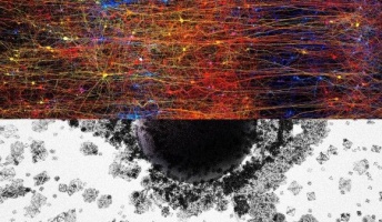 「人間の脳の構造は最大11次元」 代数的位相幾何学を用いた分析結果(スイス研究)