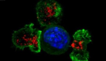 がん細胞を攻撃する“殺し屋”T細胞の撮影に成功。ミクロの戦いが壮絶すぎる!