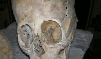 【速報】地球終了 ペルーでエイリアンの頭蓋骨見つかる 学者「明らかに人間ではない」 オワタ;;