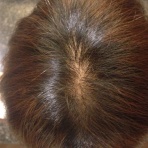 ワタシのつむじ・オレのつむじ