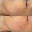 秋のフェイシャルコースの結果