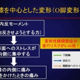 『O脚に対する対処方法』の画像