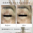 秋限定 白玉水光リセットフェイシャル  