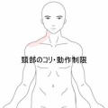 長距離運転で悪化した頸部の痛みとコリ　登別室蘭すのさき鍼灸整骨院　症例報告