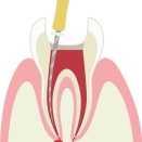 やっぱり歯の治療は来年に続く...