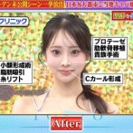 マツコ「整形女子が綺麗だと思えないの。美の基準が違いすぎて、街を歩いてる港区女子の顔が怖くて最近」