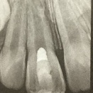 アペキソゲネシス　その4