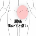 立ち上がりや屈む動作で鋭い腰痛が走るぎっくり腰 　登別室蘭すのさき鍼灸整骨院　症例報告