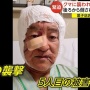 クマの爪がどれだけヤバイのかよく分かる構造が話題に　そりゃ通りで被害者がキズだらけになるわけだ…