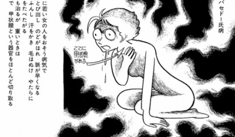 バセドウ病っていう病気の苦行がこちらwwwwww