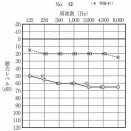 116A41  突発性難聴（SD）