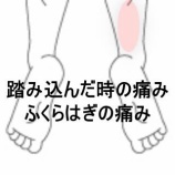 『踏み込み時に痛む右ふくらはぎの筋疲労 登別室蘭すのさき鍼灸整骨院　症例報告』の画像