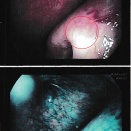  『上咽頭癌』2025年 最後の定期検診