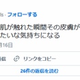 女の子「電車でジジイと肌が触れた瞬間その皮膚が汚れてそこから壊死してく気持ちになる」11万いいね