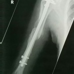 めまいに苦しむ妻との日々　-それいけチカちゃん-        　　　　　　　　　　　　　　統合失調症と診断された妻と新米主夫の〝男はつらいよ〟