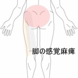 『左脚全体の感覚鈍麻と動作時に強まる腰痛・臀部痛 登別室蘭すのさき鍼灸整骨院 症例報告』の画像