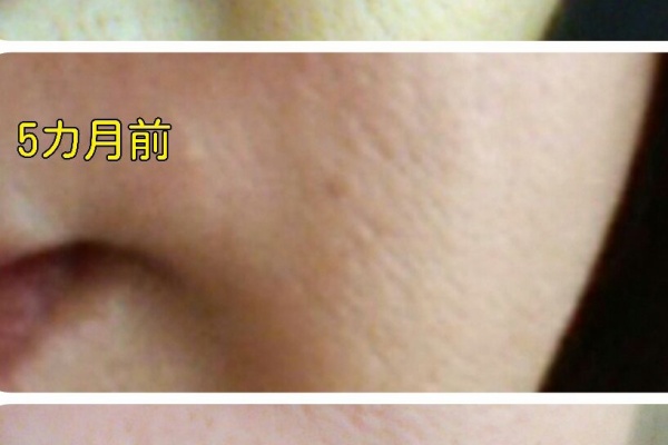 珠肌へまっしぐら 珠肌ブログ 15年03月