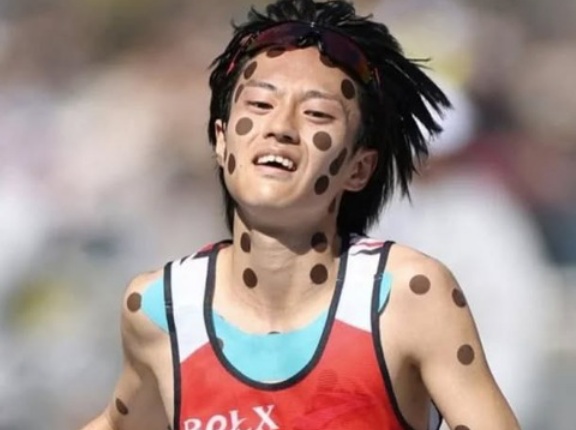 韓国「あんなのドーピングと変わらないよ！」日本のマラソン選手が身体に張った黒いシールに韓国人が異議