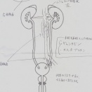 腎盂癌 闘病記② 対応は 大学病院で