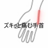『テニス後に右手首尺側がズキッと痛む 　登別室蘭すのさき鍼灸整骨院　症例報告』の画像