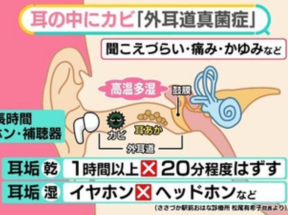 【警告】医師『これに当てはまる人、イヤホン捨ててヘッドフォンにしろ』
