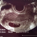 kedamarukoの不妊治療奮闘記