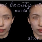 ～Dr.Fumiの美容Blog～