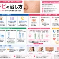 白ニキビの治し方｜初期段階で治す正しいケアと悪化させない対処法