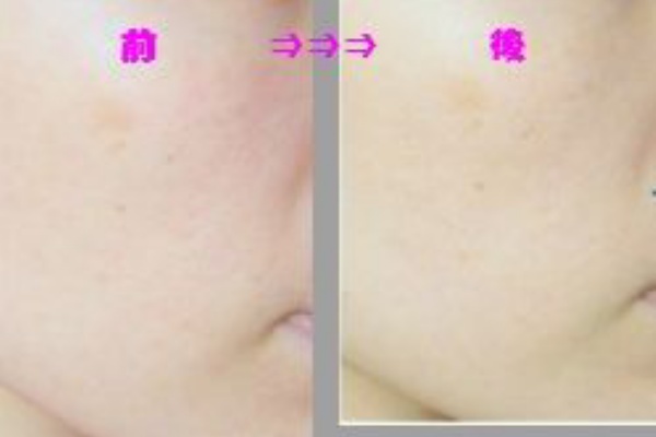 炭酸ガスパックで思いっきり美容効果体感 プレゼントの情報あり