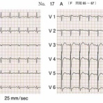 今年の医師国家試験を解いてみました