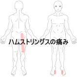 『全力で走れないサッカー選手の足の痛み 　登別室蘭すのさき鍼灸整骨院　症例報告』の画像
