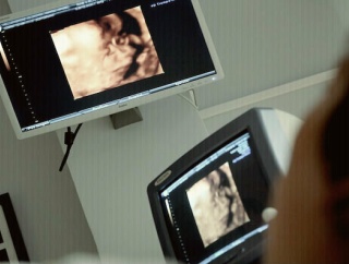 職場では若手(20代)は飲み会出席が当然だという風潮なんだけど、妊娠6ヶ月である私も強制参加させられかけている。。