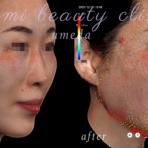 ～Dr.Fumiの美容Blog～