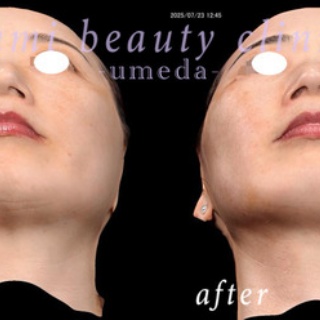 ～Dr.Fumiの美容Blog～
