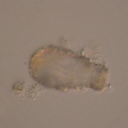 有殻アメーバ（Difflugia oblonga var. longicollis?)　ココケツボカムリ