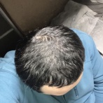 これってハゲてないよな？（※画像あり）