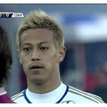 サッカー・本田圭佑の目がキョロキョロしてるにはレーシック手術失敗ではなく、バセドウ病の可能性？