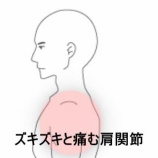 『身体を捻って後方に手を伸ばした際に生じた左肩関節のズキズキ痛 　登別室蘭すのさき鍼灸整骨院　症例報告』の画像